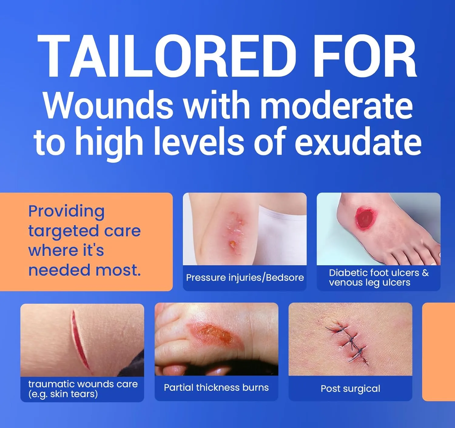 Large Waterproof Bandages 2"X5" Silicone Foam Dressing for Sensitive Skin Wound Care, 10 Packs, Adhesive Cohesive Pad with Border for First Aid, Post Surgical and Trauma Care, Sore, Burn, Pressure